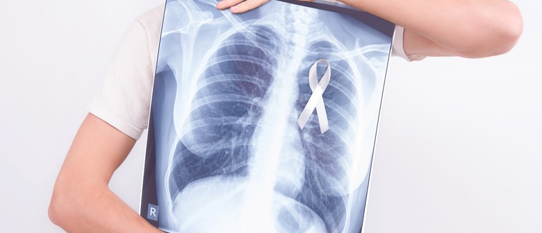 Are You At Risk? Lung Cancer Screening Campaign